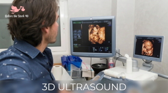 3D ultrasound scan showing a baby during a modern pregnancy experience