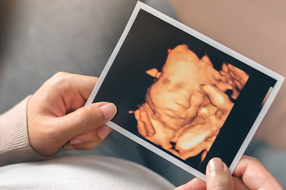 feel the happiness with 3d ultrasound